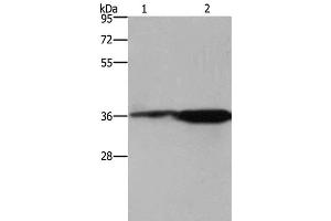 Western Blot analysis of 293T cell and Mouse brain tissue using CD89 Polyclonal Antibody at dilution of 1:550 (FCAR anticorps)