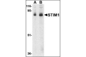 Western blot analysis of STIM1 in mouse thymus tissue lysate with this product at (A) 1 and (B) 2 μg/ml.