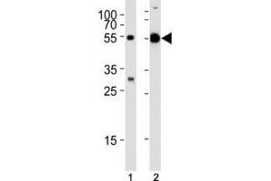 Western blot analysis of lysate from (1) mouse liver and (2) rat testis tissue lysate using TUBA1C antibody at 1:1000.