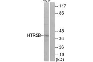 Western blot analysis of extracts from COLO cells, using HTR5B Antibody. (HTR5B anticorps  (AA 280-329))