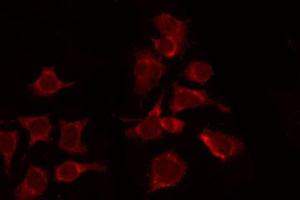ABIN6267328 staining 293 by IF/ICC. (CSF1R anticorps  (pTyr809))