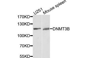 Western blot analysis of extracts of U251 and mouse spleen cells, using DNMT3B antibody. (DNMT3B anticorps)