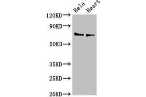 Western Blot Positive WB detected in: Hela whole cell lysate, Mouse heart tissue All lanes: PLS3 antibody at 3. (Plastin 3 anticorps  (AA 310-455))