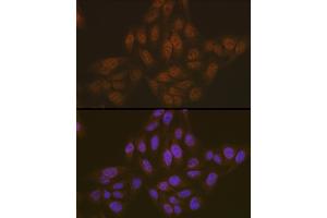 Immunofluorescence analysis of U-2 OS cells using ASC/TMS1 Rabbit pAb (ABIN7269756) at dilution of 1:100 (40x lens).