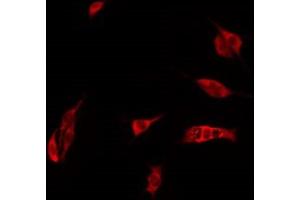 ABIN6274974 staining Hela by IF/ICC. (CEACAM21 anticorps  (C-Term))