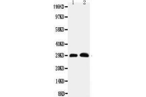 Anti-Aquaporin 5 antibody, Western blotting Lane 1: Rat Lung Tissue Lysate Lane 2: Rat Testis Tissue Lysate (Aquaporin 5 anticorps  (C-Term))