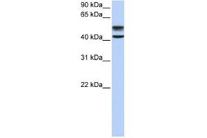 GNS antibody used at 1 ug/ml to detect target protein. (GNS anticorps  (C-Term))