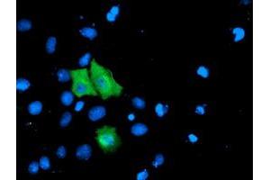 Anti-TOMM34 mouse monoclonal antibody (ABIN2454766) immunofluorescent staining of COS7 cells transiently transfected by pCMV6-ENTRY TOMM34 (RC201083). (TOMM34 anticorps)