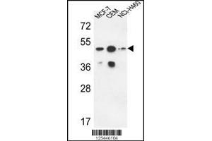 Western blot analysis in MCF-7,CEM,NCI-H460 cell line lysates (35ug/lane). (Sphingomyelin Synthase 2 anticorps  (C-Term))