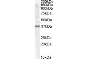 Western Blotting (WB) image for anti-Component of Oligomeric Golgi Complex 6 (COG6) (C-Term) antibody (ABIN2787226) (COG6 anticorps  (C-Term))