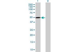 Western Blot analysis of MASP1 expression in transfected 293T cell line by MASP1 MaxPab polyclonal antibody. (MASP1 anticorps  (AA 1-380))