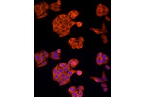 Immunofluorescence analysis of HeLa cells using  Rabbit pAb (ABIN1678685, ABIN3015308, ABIN3015309 and ABIN6213977) at dilution of 1:150 (40x lens). (APAF1 anticorps  (AA 1-250))