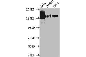 Western Blot Positive WB detected in: Hela whole cell lysate, Jurkat whole cell lysate, K562 whole cell lysate All lanes: SA2 antibody at 1:1000 Secondary Goat polyclonal to rabbit IgG at 1/50000 dilution Predicted band size: 142, 146 kDa Observed band size: 142 kDa (Recombinant STAG2 anticorps)
