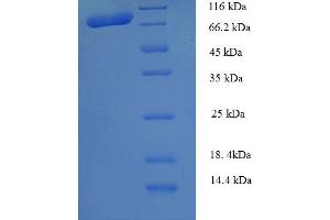 SDS-PAGE (SDS) image for Calpain 1 (CAPN1) (AA 1-714), (full length) protein (His tag) (ABIN5709187)