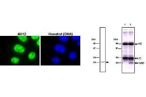 Immunohistochemistry (IHC) image for anti-Small Nuclear Ribonucleoprotein Polypeptide C (SNRPC) (full length) antibody (ABIN2452159)