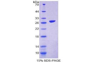 SDS-PAGE (SDS) image for Signal-Regulatory Protein beta 1 (SIRPB1) (AA 129-342) protein (His tag) (ABIN2126756)