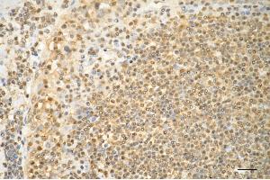 Immunohistochemistry was performed on paraffin-embedded human tonsillitis using CD86 antibody (ABIN7797984), 1:200).