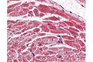 Anti-PIK3CA antibody IHC of human heart. (PIK3CA anticorps  (AA 878-891))