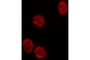 ABIN6275194 staining  COLO205 cells by IF/ICC. (Msx2/Hox8 anticorps  (Internal Region))