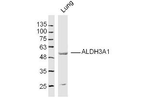 Mouse lung lysates probed with ALDH3A1 Polyclonal Antibody, Unconjugated  at 1:300 dilution and 4˚C overnight incubation. (ALDH3A1 anticorps  (AA 151-250))
