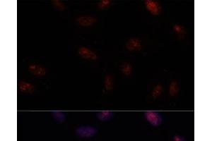 Immunofluorescence analysis of U-2 OS cells using SF3B1 Polyclonal Antibody at dilution of 1:100. (SF3B1 anticorps)