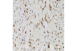 Immunohistochemistry of paraffin-embedded human adenomyosis using NASP Antibody.