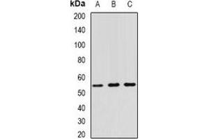 Western blot analysis of RNF81 expression in A549 (A), SW620 (B), HT29 (C) whole cell lysates. (TRIM21 anticorps)