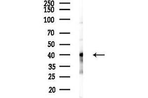 Western blot analysis of lysates from Hela cells(heat-shock 45 min treatment), using PRPF38A Antibody at 1/1000 dilution.