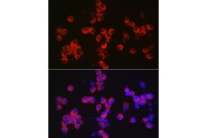 Immunofluorescence analysis of Neuro-2a cells using C Rabbit pAb (ABIN6130035, ABIN6137891, ABIN6137892 and ABIN6220925) at dilution of 1:100 (40x lens).