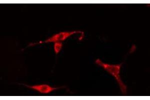 ABIN6274771 staining HeLa cells by IF/ICC.