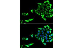 Immunofluorescence analysis of U2OS cells using GOT1 antibody (ABIN6131239, ABIN6141283, ABIN6141284 and ABIN6221514). (GOT1 anticorps  (AA 244-413))