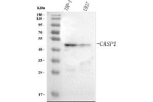 Western blot analysis of Caspase 1(P20)/CASP1 using anti-Caspase 1(P20)/CASP1 antibody (ABIN7599966).