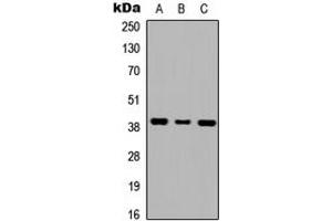 Western blot analysis of GALR1 expression in HEK293T (A), NS-1 (B), H9C2 (C) whole cell lysates. (Galanin Receptor 1 anticorps  (Center))