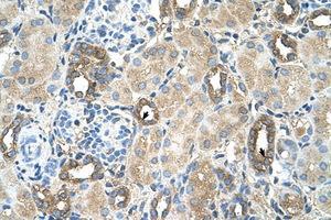 Image no. 1 for anti-Mannosyl (Alpha-1,6-)-Glycoprotein beta-1,2-N-Acetylglucosaminyltransferase (MGAT2) (AA 201-250) antibody (ABIN205059)