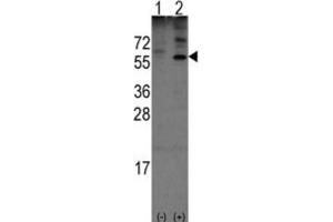 Western Blotting (WB) image for anti-Olfactomedin 1 (OLFM1) antibody (ABIN3001576) (Olfactomedin 1 anticorps)