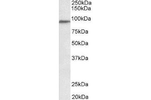 ABIN2564792 (0. (PTCHD3 anticorps  (Internal Region))
