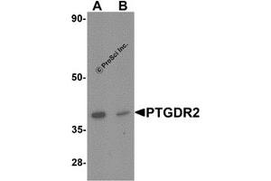 Western Blotting (WB) image for anti-Prostaglandin D2 Receptor 2 (PTGDR2) antibody (ABIN1077429) (Prostaglandin D2 Receptor 2 (PTGDR2) anticorps)