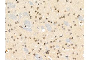 Phospho-MKK3/MKK6 (Ser189/Ser207) Antibody at 1/100 staining Mouse brain tissue by IHC-P. (MAP2K3 anticorps  (pSer189, pSer207))