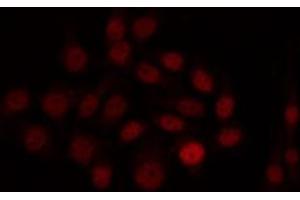 ABIN6266978 staining HuvEc by IF/ICC. (SIX Homeobox 6 anticorps  (Internal Region))