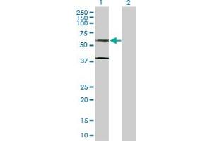 Western Blot analysis of AHCYL1 expression in transfected 293T cell line by AHCYL1 MaxPab polyclonal antibody.