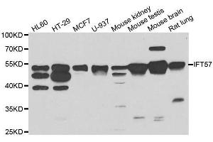 Western blot analysis of extracts of various cell lines, using IFT57 antibody. (IFT57 anticorps  (AA 170-429))