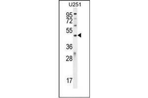Western blot analysis of IPCEF1 / PIP3-E Antibody (C-term) in U251 cell line lysates (35ug/lane). (ICEF1 anticorps  (C-Term))