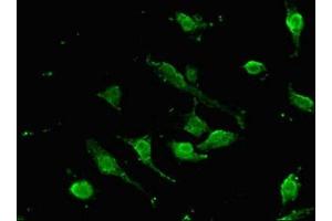 Immunofluorescent analysis of U251 cells using ABIN7172642 at dilution of 1:100 and Alexa Fluor 488-congugated AffiniPure Goat Anti-Rabbit IgG(H+L)