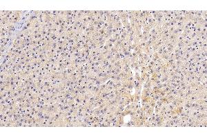 Detection of GLb in Human Liver Tissue using Polyclonal Antibody to Galactosidase Beta (GLb)