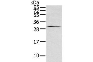Gel: 12 % SDS-PAGE, Lysate: 40 μg, Lane: Mouse brain tissue, Primary antibody: ABIN7193096(ZFAND2B Antibody) at dilution 1/200 dilution, Secondary antibody: Goat anti rabbit IgG at 1/8000 dilution, Exposure time: 1 minute