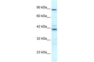 Western Blotting (WB) image for anti-T-Box 5 (TBX5) antibody (ABIN2460713)