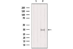 Western blot analysis of extracts from HepG2, using SULT1A1  Antibody.