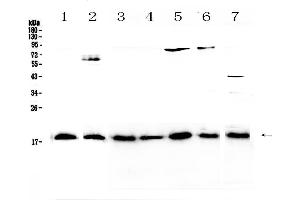 Western blot analysis of IL23 using anti-IL23 antibody . (IL23A anticorps  (AA 20-178))