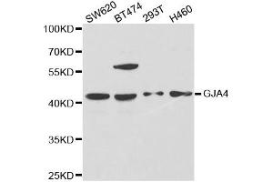 Western Blotting (WB) image for anti-Gap Junction Protein, alpha 4, 37kDa (GJA4) antibody (ABIN1872819)