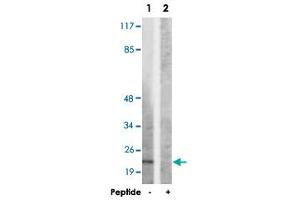 Western blot analysis of extracts from HepG2 cells, using SDC4 polyclonal antibody . (SDC4 anticorps  (Ser179))